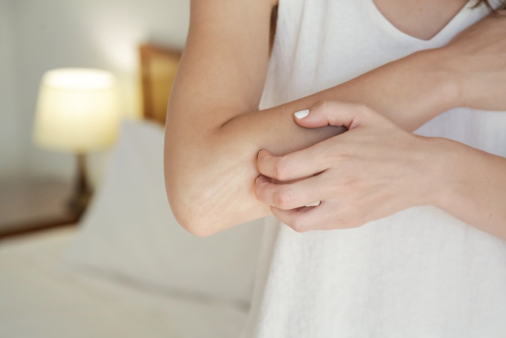 A person scratching the skin on their arms